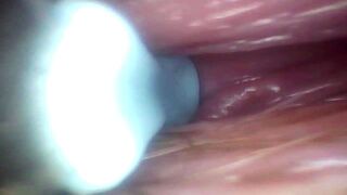 Recorded close-up of a woman's G-spot (the camera probe goes deep into her)
