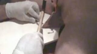 Extreme CBT - Nails with Electricity