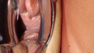 Stretching her peehole