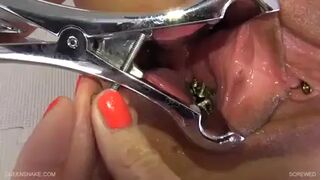 poked - Extreme pussy torment