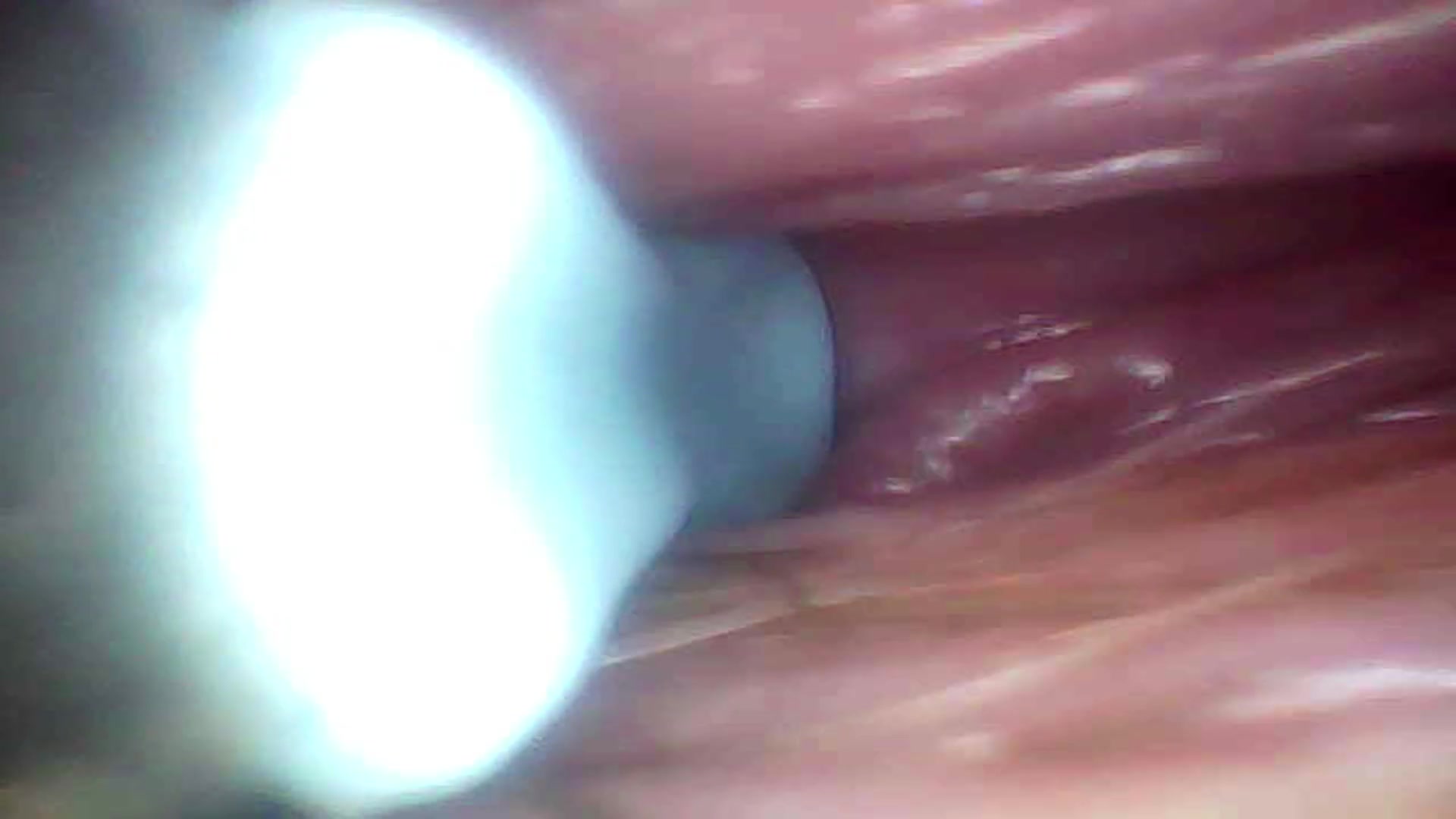 Recorded close-up of a woman's G-spot (the camera probe goes deep into her)